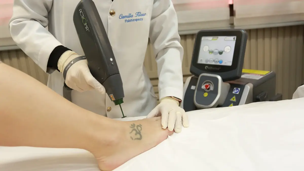 Procedimento dermatológico realizado com equipamento a laser na Clínica Neoderme