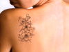 Promoção: remoção de tatuagem em Curitiba