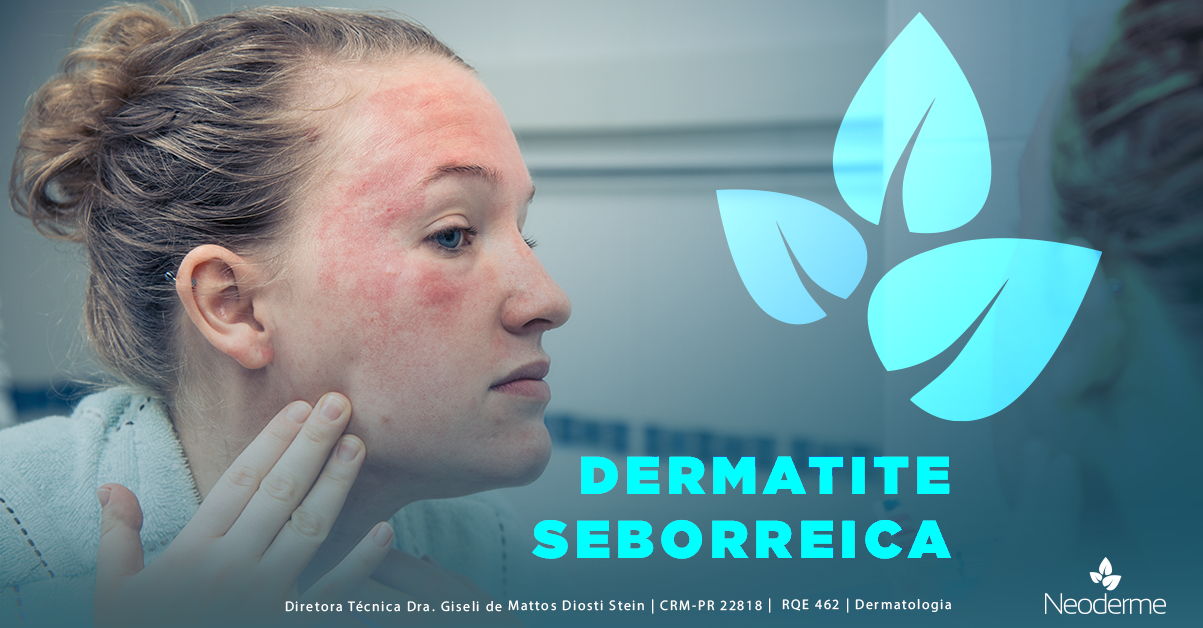 Saiba que fatores podem causar dermatite seborreica