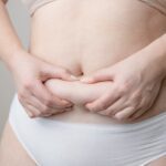 Gordura localizada: quais as causas e como é o tratamento na Neoderme?